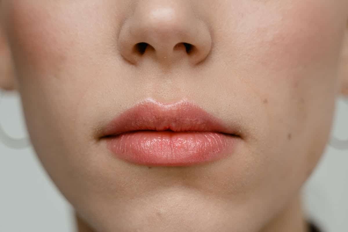 Tout savoir sur les lèvres décolorées et leur traitement efficace